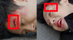 正宇頭上疤痕時隱時現(xiàn)